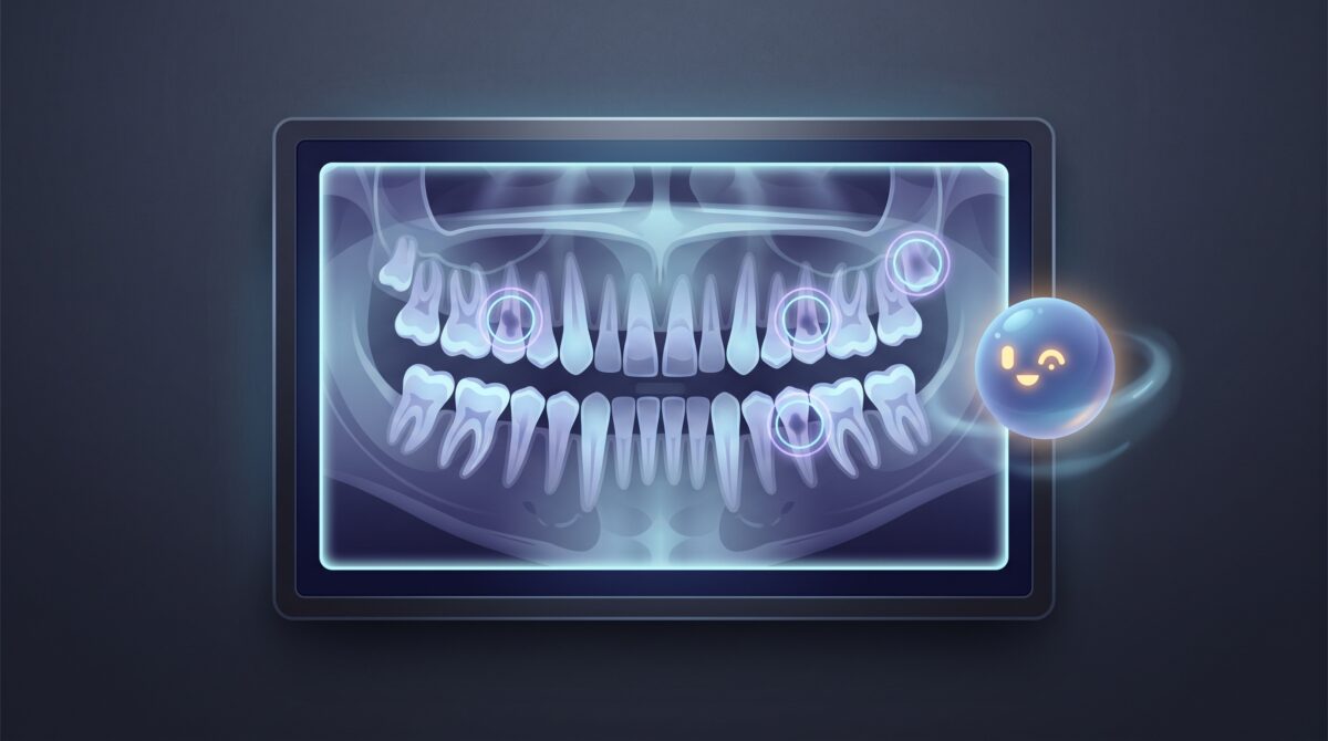 An AI highlighting areas of interest on a dental X-ray